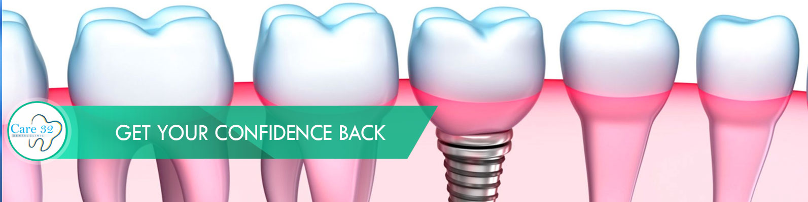 Missing-Teeth-Tooth-Replacement-Mumbai