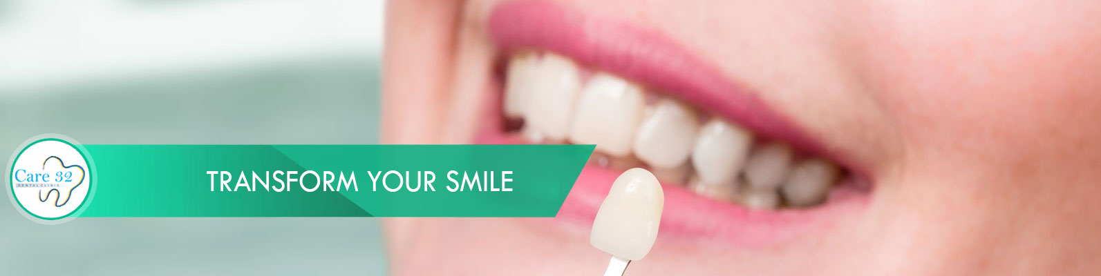 Dental-Veneers-Andheri-East-Mumbai