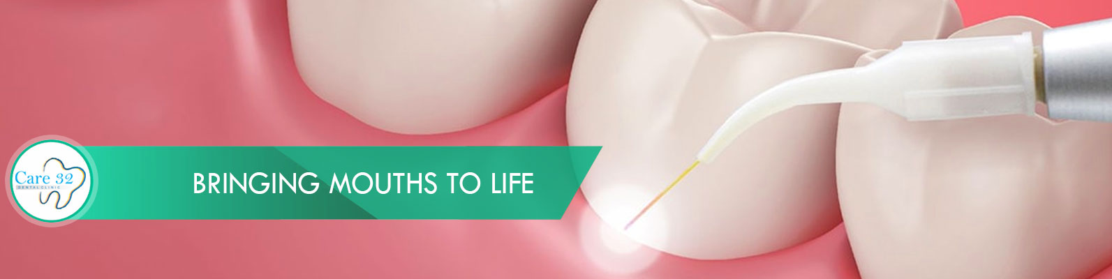 Gum-Depigmentation-Treatment-Mumbai