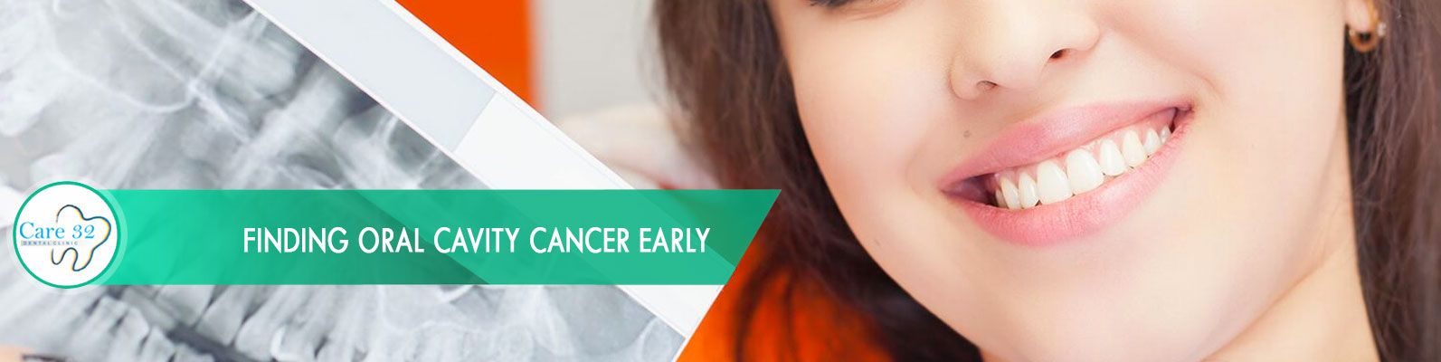 Oral-Cancer-Treatment-Mumbai-Andheri-East